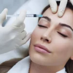 Benefits of Botox Injections